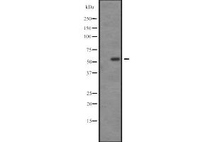 Western blot analysis of SGK3 expression in U-87 MG whole cell lysate ,The lane on the left is treated with the antigen-specific peptide. (SGK3 Antikörper  (C-Term))