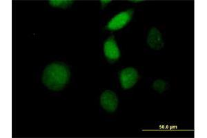 Immunofluorescence of purified MaxPab antibody to MORF4 on HeLa cell. (MORF4 Antikörper  (AA 1-235))