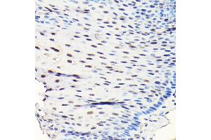 Immunohistochemistry (IHC) image for anti-GTP Binding Protein 4 (GTPBP4) (AA 385-634) antibody (ABIN1680142)