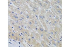 Immunohistochemistry of paraffin-embedded Human liver using PTTG1 Polyclonal Antibody at dilution of 1:100 (40x lens). (PTTG1 Antikörper)