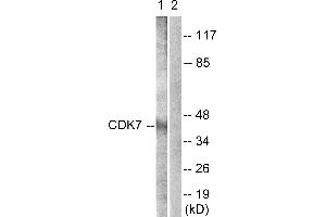 Immunohistochemistry analysis of paraffin-embedded human breast carcinoma tissue using CDK7 (Ab-170) antibody. (CDK7 Antikörper  (Thr170))