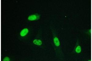 IF analysis of RPA70 using anti-RPA70 antibody (ABIN6719369).