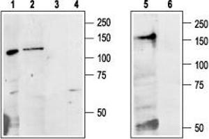 Western blot analysis of Colo205 (lanes 1 and 3), rat liver (lanes 2 and 4) and mouse kidney (lanes 5 and 6) lysates: - 1,2,5. (CASR Antikörper  (Extracellular, N-Term))