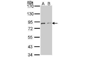 WB Image Sample (30 ug of whole cell lysate) A: A431 , B: H1299 7. (NEK4 Antikörper)