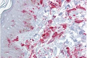 Immunohistochemistry with Skin, dermal fibroblasts tissue at an antibody concentration of 5µg/ml using anti-ZFP36L2 antibody (ARP33383_P050)