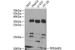 Western blot analysis of extracts of various cell lines, using TP53 antibody (ABIN6130604, ABIN6149410, ABIN6149412 and ABIN6218410) at 1:1000 dilution. (TP53AIP1 Antikörper  (AA 1-108))