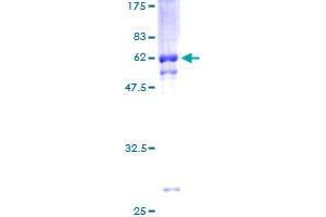 Image no. 1 for Plasminogen Activator, Urokinase Receptor (PLAUR) (AA 1-335) protein (GST tag) (ABIN2565183)