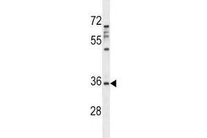 Aurora-C antibody western blot analysis in MDA-MB231 lysate. (Aurora Kinase C Antikörper  (AA 3-38))