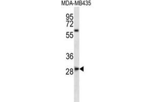 Western Blotting (WB) image for anti-SLAM Family Member 8 (SLAMF8) antibody (ABIN2997003) (SLAMF8 Antikörper)