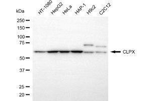 Western blotting analysis using CLPX antibody (ABIN7798101). (Rekombinanter CLPX Antikörper)