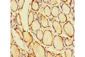 Immunohistochemistry of paraffin-embedded human thyroid tissue using ABIN7153535 at dilution of 1:100 (CRYGN Antikörper  (AA 1-182))