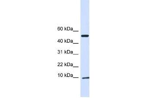 Western Blotting (WB) image for anti-ATPase Inhibitory Factor 1 (ATPIF1) antibody (ABIN2459198)