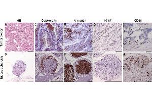 Immunohistochemistry (IHC) image for anti-Keratin 20 (KRT20) antibody (ABIN2856768)