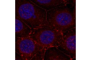 Immunofluorescence staining of methanol-fixed MCF7 cells using Phospho-IGF1R-Y1161 antibody.