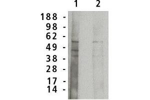 Western blot analysis using acid  sphingomyelinase antibody on normal human brain lysate (7 µg/lane). (SMPD1 Antikörper)