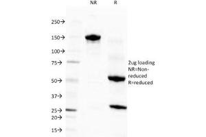 SDS-PAGE Analysis of Purified, BSA-Free Eosinophil Peroxidase Antibody (clone EPO104). (EPX Antikörper)