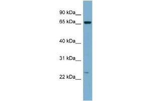 WB Suggested Anti-ZNF572 Antibody Titration:  0. (ZNF572 Antikörper  (Middle Region))