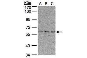 WB Image Sample(30 μg of whole cell lysate) A:293T B:A431, C:H1299 7. (EPM2AIP1 Antikörper  (N-Term))