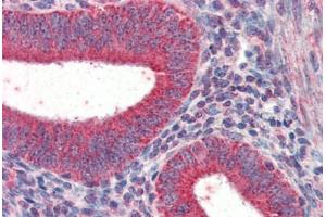 Human Uterus (formalin-fixed, paraffin-embedded) stained with TRIM5 antibody ABIN337284 at 5 ug/ml followed by biotinylated anti-goat IgG secondary antibody ABIN481715, alkaline phosphatase-streptavidin and chromogen. (TRIM5 Antikörper  (AA 2-15))