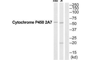 Western Blotting (WB) image for anti-Cytochrome P450, Family 2, Subfamily A, Polypeptide 7 (CYP2A7) (Internal Region) antibody (ABIN1852656) (CYP2A7 Antikörper  (Internal Region))