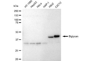 Western blotting analysis using Biglycan antibody (ABIN7797769).
