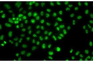 Immunofluorescence analysis of HeLa cells using LHX8 Polyclonal Antibody