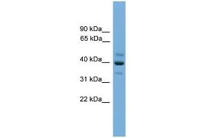 WB Suggested Anti-BNIPL Antibody Titration: 0. (BNIPL Antikörper  (Middle Region))