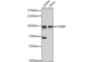 Western blot analysis of extracts of various cell lines, using ATRIP antibody (ABIN1678799, ABIN3019346, ABIN3019347 and ABIN6220835) at 1:1000 dilution. (ATRIP Antikörper  (AA 1-260))