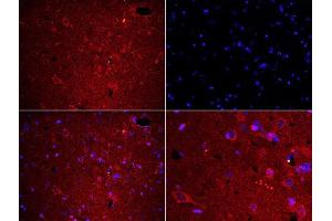 Formalin-fixed and paraffin embedded rat brain labeled with Rabbit Anti-Fibrinogen alpha chain Polyclonal Antibody, Unconjugated used at 1:200 dilution for 40 minutes at 37°C. (FGA Antikörper  (AA 61-160))