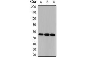 Western blot analysis of CSN1 expression in HEK293T (A), SKOV3 (B), mouse brain (C) whole cell lysates. (GPS1 Antikörper)