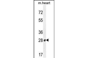 Western blot analysis in mouse heart tissue lysates (35ug/lane). (B3GAT2 Antikörper  (AA 123-150))