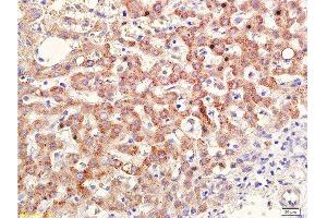 Immunohistochemistry (Paraffin-embedded Sections) (IHC (p)) image for anti-Retinoic Acid Receptor, beta (RARB) (AA 155-250) antibody (ABIN669516)