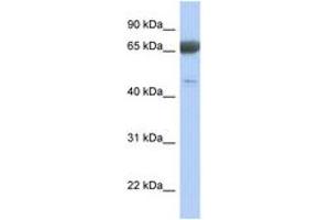 Image no. 1 for anti-Paraneoplastic Antigen MA3 (PNMA3) (AA 359-408) antibody (ABIN6743787) (PNMA3 Antikörper  (AA 359-408))