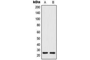 Western blot analysis of Tetraspanin 8 expression in human colon (A), COLO205 (B) whole cell lysates. (Tspan-8 Antikörper  (Center))