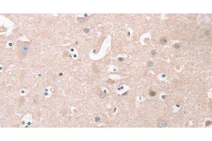 Immunohistochemistry of paraffin-embedded Human brain tissue using CDCA4 Polyclonal Antibody at dilution 1:50 (CDCA4 Antikörper)