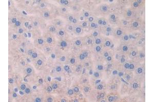 Immunohistochemistry (IHC) image for anti-Angiogenic Factor with G Patch and FHA Domains 1 (AGGF1) (AA 263-507) antibody (ABIN1857943)