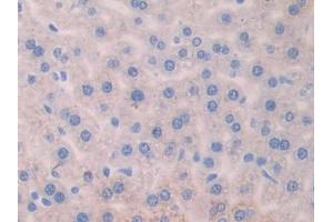 DAB staining on IHC-P; Samples: Mouse Liver Tissue (AGGF1 Antikörper  (AA 263-507))