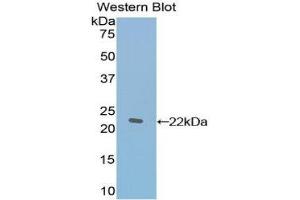 Western Blotting (WB) image for anti-TAF12 RNA Polymerase II, TATA Box Binding Protein (TBP)-Associated Factor, 20kDa (TAF12) (AA 1-161) antibody (ABIN1860675) (TAF12 Antikörper  (AA 1-161))