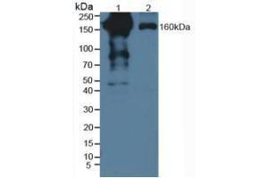 Western blot analysis of (1) Human Serum and (2) Human Lung Tissue. (PZP Antikörper  (AA 1212-1391))