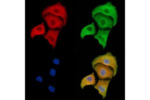 BTF3L3 Antibody staining A549 cells by IF/ICC. (BTF3P13 Antikörper)