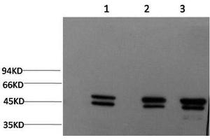 Western Blot analysis of 1) MCF7, 2) Rat brain, 3) Mouse brain using Epsilon Tubulin Monoclonal Antibody at dilution of 1:2000. (TUBE1 Antikörper)