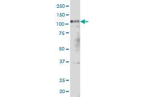 PTK2 monoclonal antibody (M02), clone 1C1 Western Blot analysis of PTK2 expression in Hela S3 NE . (FAK Antikörper  (AA 355-490))