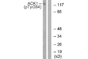 Western blot analysis of extracts from HepG2 cells, treated with EGF (200 ng/mL, 30 mins), using ACK1 (Phospho-Tyr284) antibody. (TNK2 Antikörper  (pTyr284))