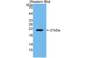 Western blot analysis of the recombinant protein. (POTEG Antikörper  (AA 177-330))