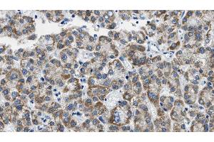Immunohistochemistry (IHC) image for anti-CD4 (CD4) (C-Term) antibody (ABIN6260621)