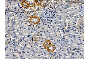 ABIN6262753 and ABIN6279177 at 1/100 staining mouse kidney tissue by IHC-P. (KCNJ8 Antikörper)