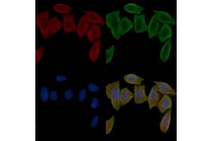 ABIN6261825 and ABIN6276547 staining Hela cells(30 min of UV treatment) by IF/ICC. (FTH1 Antikörper  (C-Term))