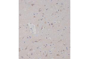 Immunohistochemistry (Paraffin-embedded Sections) (IHC (p)) image for anti-Sphingosine Kinase 2 (SPHK2) (AA 590-620), (C-Term) antibody (ABIN391349)