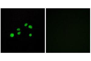 Immunofluorescence (IF) image for anti-Collagen, Type XXIII, alpha 1 (COL23A1) (C-Term) antibody (ABIN1850316) (COL23A1 Antikörper  (C-Term))
