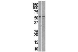 Reptin antibody used in western blot to detect RUVBL2 in mouse kidney (left) and SK-Br-3 (right) lysate (RUVBL2 Antikörper  (AA 400-430))